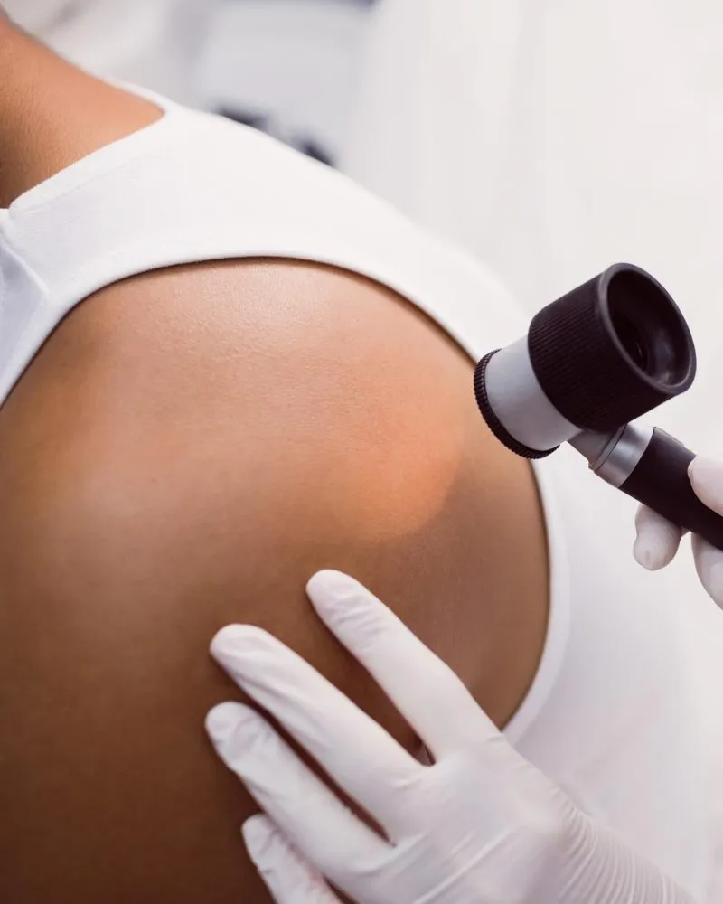 Visita dermatologica a Zero Branco Treviso - dermatologo Zero Medical Center