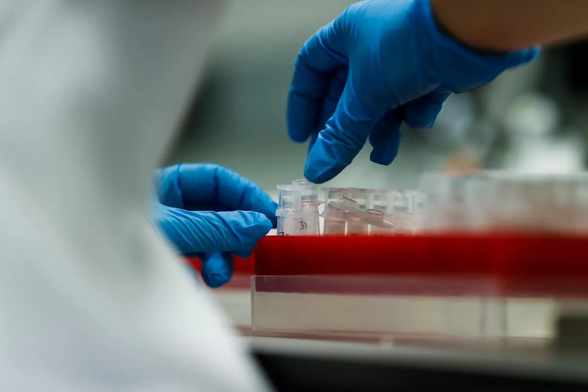 Laboratorio analisi esami del sangue Treviso
