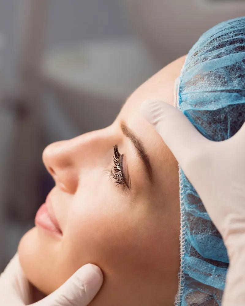 Biorivitalizzazione viso Treviso
