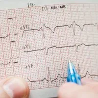 Elettrocardiogramma ECG eseguito da Zero Medical Center Treviso Zero Branco
