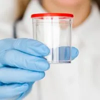 Esame feci sangue occulto presso Zero Medical Center Treviso Zero Branco