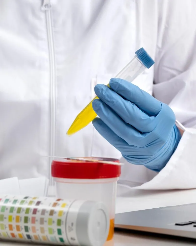 Esame tossicologico urine drug test Zero Branco Treviso Medicina Legale zero medical center