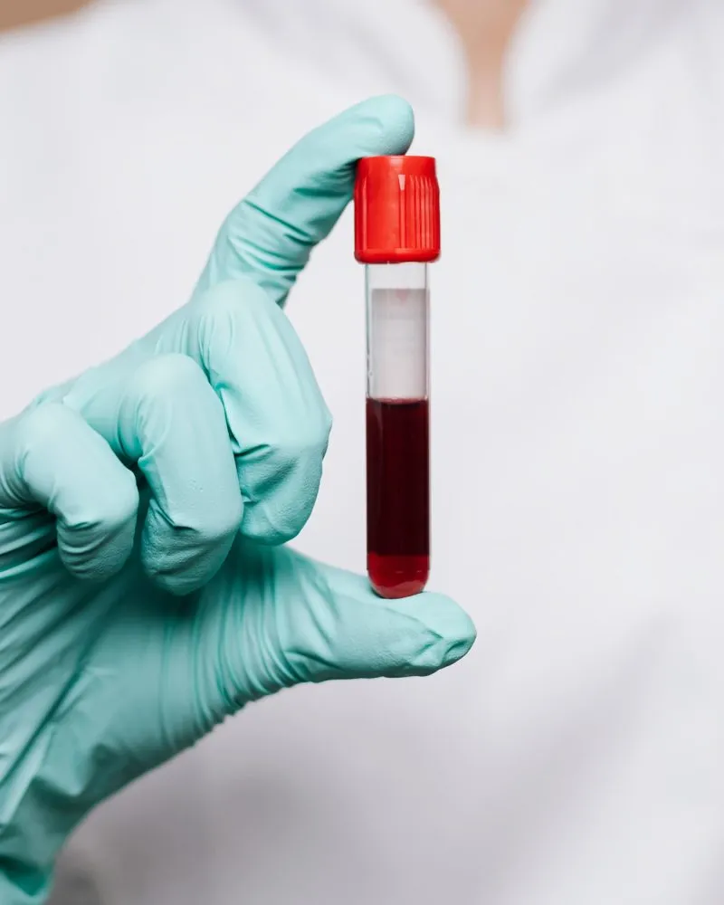 Esami ematochimici prelievo venoso analisi del sangue a treviso zero branco