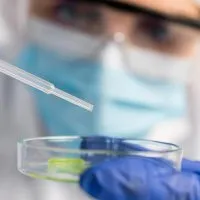 Prelievi microbiologici analisi Treviso