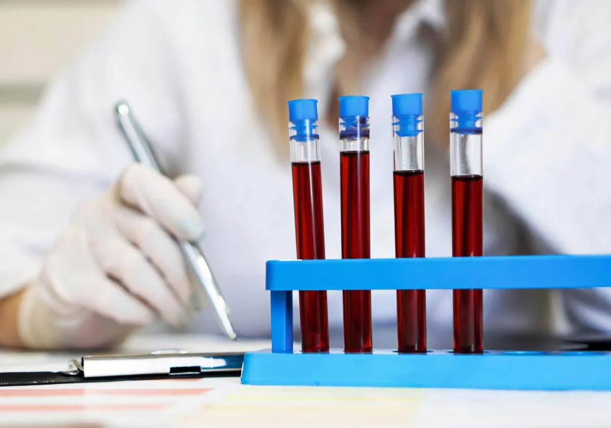 laboratorio analisi del sangue treviso zero branco